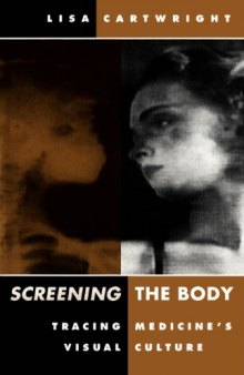 Screening the Body: Tracing Medicine's Visual Culture