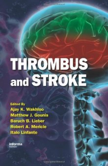 Thrombus and Stroke (Neurological Disease and Therapy)