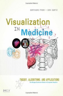 Visualization in medicine. Theory, algorithms, and applications