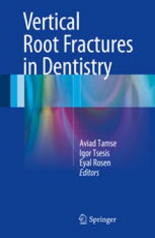 Vertical Root Fractures in Dentistry