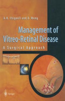 Management of Vitreo-Retinal Disease: A Surgical Approach