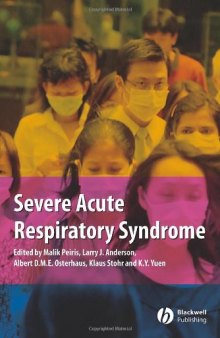Severe Acute Respiratory Syndrome