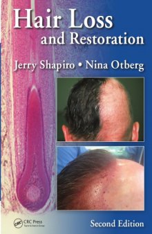 Hair Loss and Restoration