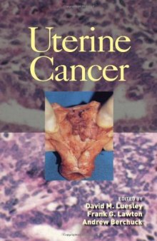 Uterine Cancer