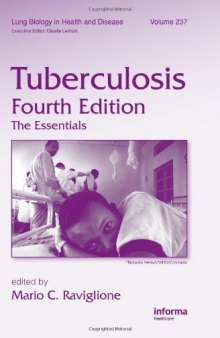 Tuberculosis: The Essentials, Fourth Edition 