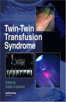 Twin-Twin Transfusion Syndrome