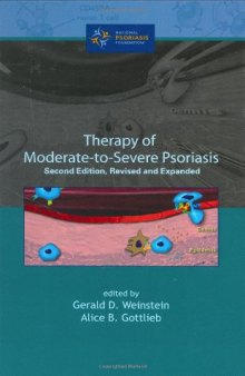 Therapy of Moderate-to-Severe-Psoriasis, 