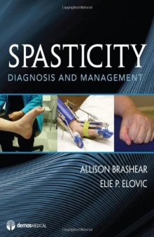 Spasticity: Diagnosis and Management  