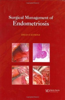 Surgical Management of Endometriosis