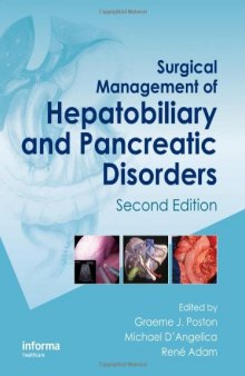 Surgical Management of Hepatobiliary and Pancreatic Disorders, Second Edition (Oncologysurgery)