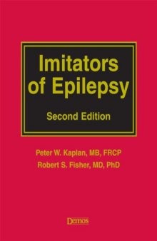 Imitators of Epilepsy, Second Edition