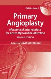 Primary Angioplasty: Mechanical Interventions for Acute Myocardial Infarction