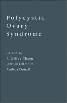 Polycystic Ovary Syndrome  