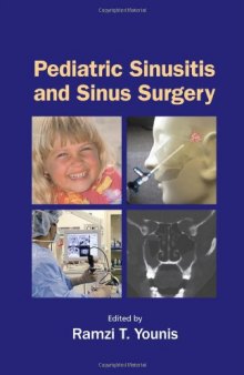 Pediatric Sinusitis and Sinus Surgery