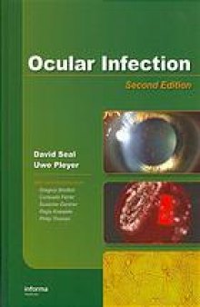 Ocular infection