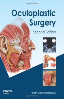 Oculoplastic Surgery, Second Edition  