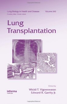 Lung Transplantation 