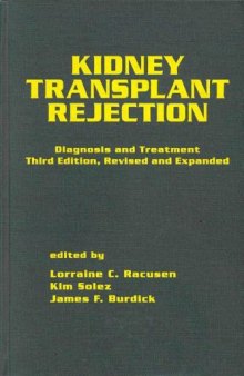 Kidney Transplant Rejection: Diagnosis & Treatment