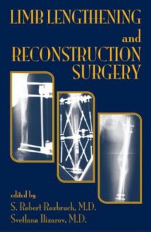 Limb lengthening and reconstructive surgery