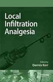 Local infiltration analgesia: a technique to improve outcomes after hip, knee, and lumbar spine surgery