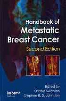 Handbook of metastatic breast cancer