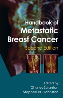 Handbook of Metastatic Breast Cancer: Second Edition  