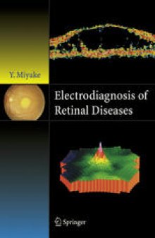 Electrodiagnosis of Retinal Diseases