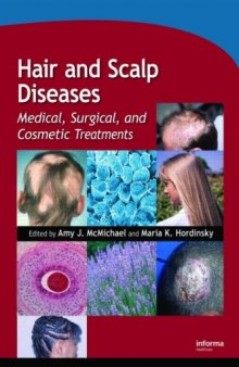 Hair and Scalp Diseases: Medical, Surgical, and Cosmetic Treatments 