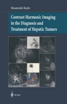 Contrast Harmonic Imaging in the Diagnosis and Treatment of Hepatic Tumors