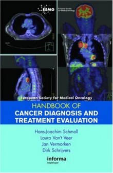 ESMO Handbook of Cancer Diagnosis and Treatment Evaluation (European Society for Medical Oncology Handbooks)