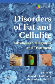 Disorders of Fat and Cellulite: Advances in Diagnosis and Treatment (Series in Cosmetic and Laser Therapy)  