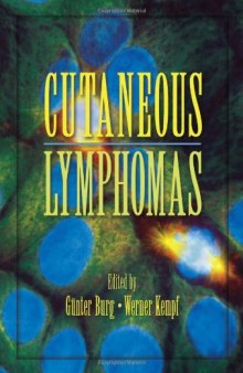 Cutaneous Lymphomas (Basic and Clinical Dermatology)