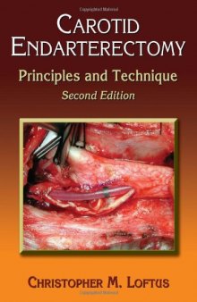 Carotid Endarterectomy: Principles and Technique, Second Edition