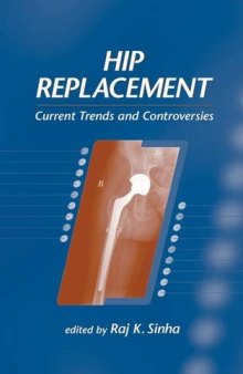 Hip replacement : current trends and controversies