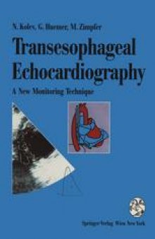 Transesophageal Echocardiography: A New Monitoring Technique