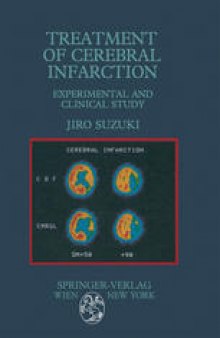 Treatment of Cerebral Infarction: Experimental and Clinical Study