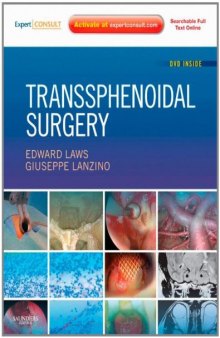 Transsphenoidal Surgery: Expert Consult - Online and Print  