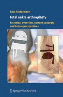 Total Ankle Arthroplasty: Historical Overview, Current Concepts and Future Perspectives