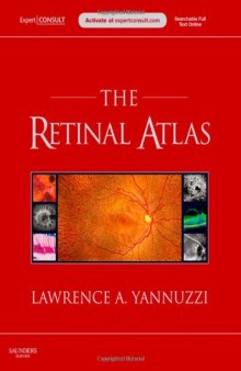 The Retinal Atlas: Expert Consult - Online and Print