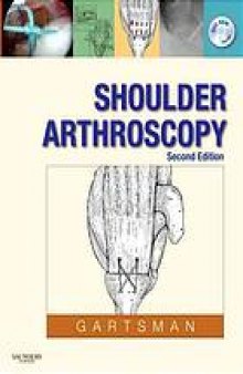 Shoulder arthroscopy