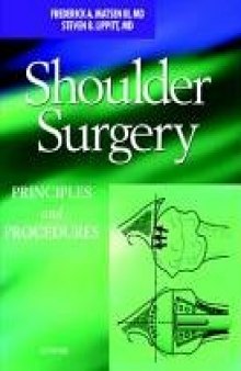 Shoulder Surgery: Principles and Procedures  