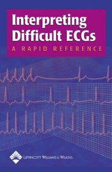 Interpreting Difficult ECGs: A Rapid Reference 