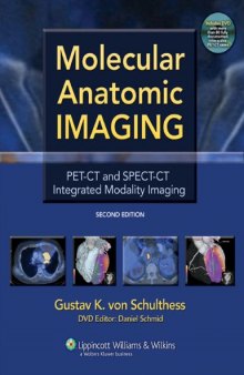 Molecular Anatomic Imaging: PET-CT and SPECT-CT Integrated Modality Imaging, 2nd Edition