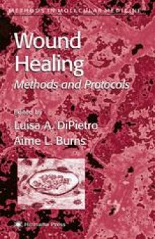 Wound Healing: Methods and Protocols