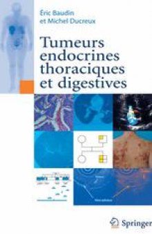 Tumeurs endocrines thoraciques et digestives