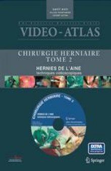 Video-Atlas Chirurgie Herniaire: Hernies De L’Aine techniques vidéoscopiques