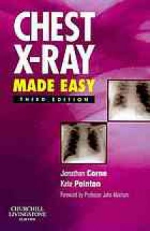 Chest x-ray made easy