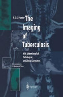 The Imaging of Tuberculosis: With Epidemiological, Pathological, and Clinical Correlation