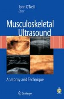 Musculoskeletal Ultrasound: Anatomy and Technique