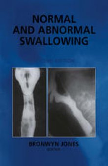 Normal and Abnormal Swallowing: Imaging in Diagnosis and Therapy